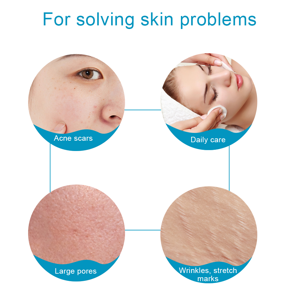 Haut-Gesichtspflege, Mikronadel-Derma-Roller für Haarwachstum, Bartwachstum, Gesichtsschönheitsroller, 540, Mikro-Nadel-Dermaroller-Werkzeug