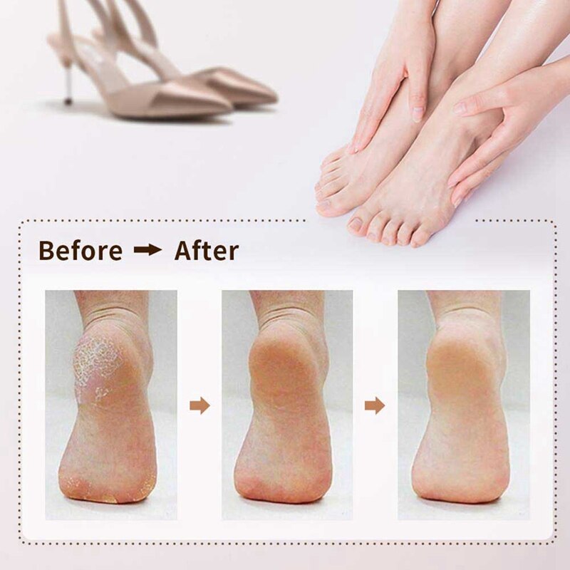 Electric Callus Remover, Rechargeable Electronic Feet File Pedicure Foot File Foot Rasp with IPX7 Waterproof