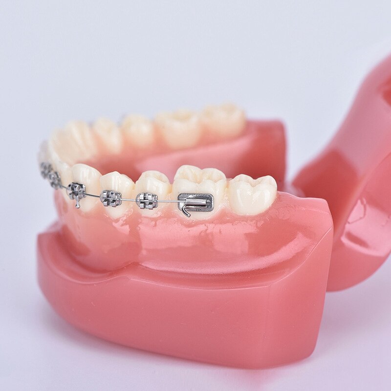 Teeth Model Implant Disease Teeth Model Dentist Studying Model