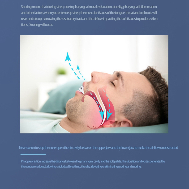Anti Snoring Device Sleeping Aid Apnea Solutions Silent Sleep Aid Device