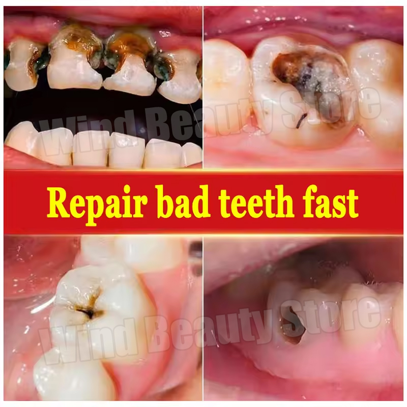 120 g probiotische Karies-Zahnpasta SP 4 aufhellende Zahnkaries-Reparaturpaste, Zahnreiniger, Plaque-Entferner, frischer Atem, Zahnpflege