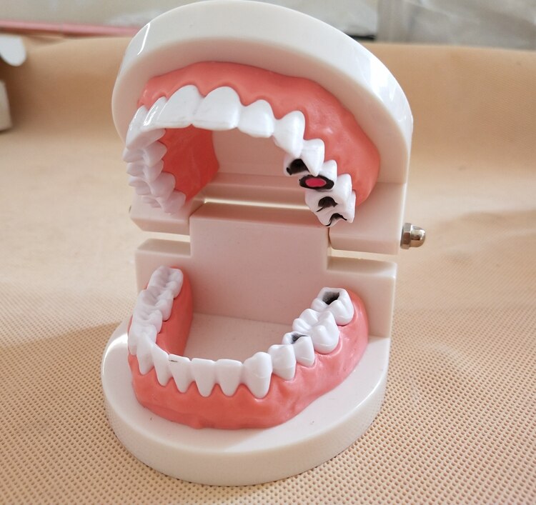 Dental Implant Teeth Model Teaching Study Model Dentist Resin Tooth Orthodontic Modeling For Student Practice: TYPE2  (1PCS)