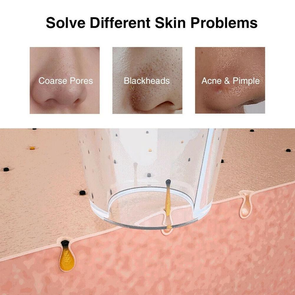 Rimozione visiva di punti neri detergente per pori rimozione dell'acne riscaldamento profondo pulizia del microscopio telecamera wifi naso elettrico viso I5I4