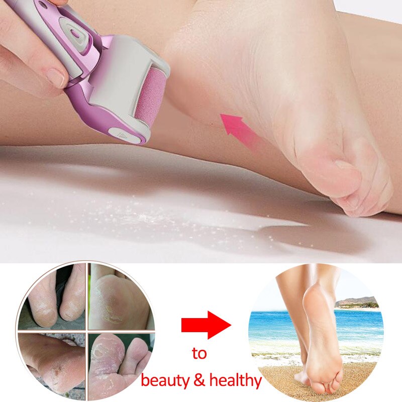 Electric foot file for heel foot care pedicura tools, file for foot callus removal foot care Pedicure machine