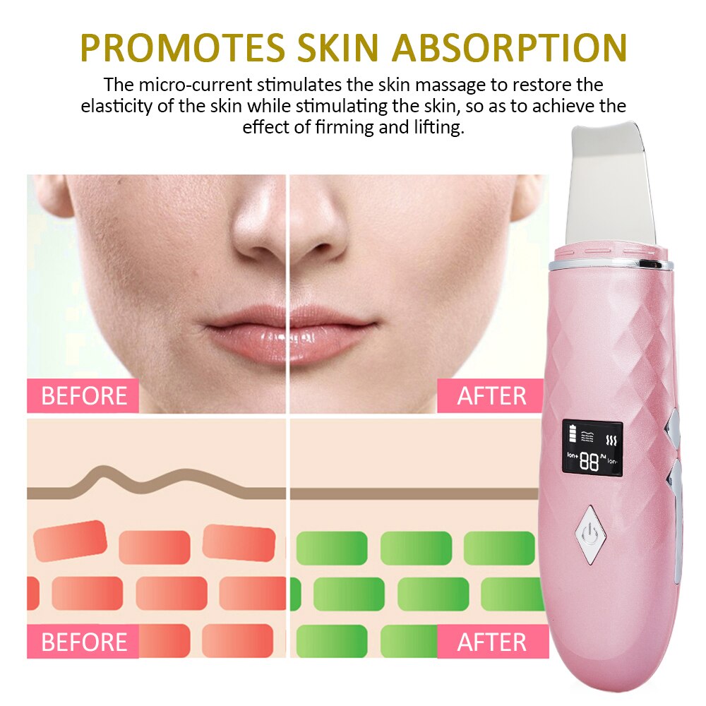 Depurador de piel con calor de 45 °C + rociador Facial de Nano ultrasónico, pala exfoliante eléctrica, limpiador de poros, masajeador de estiramiento Facial