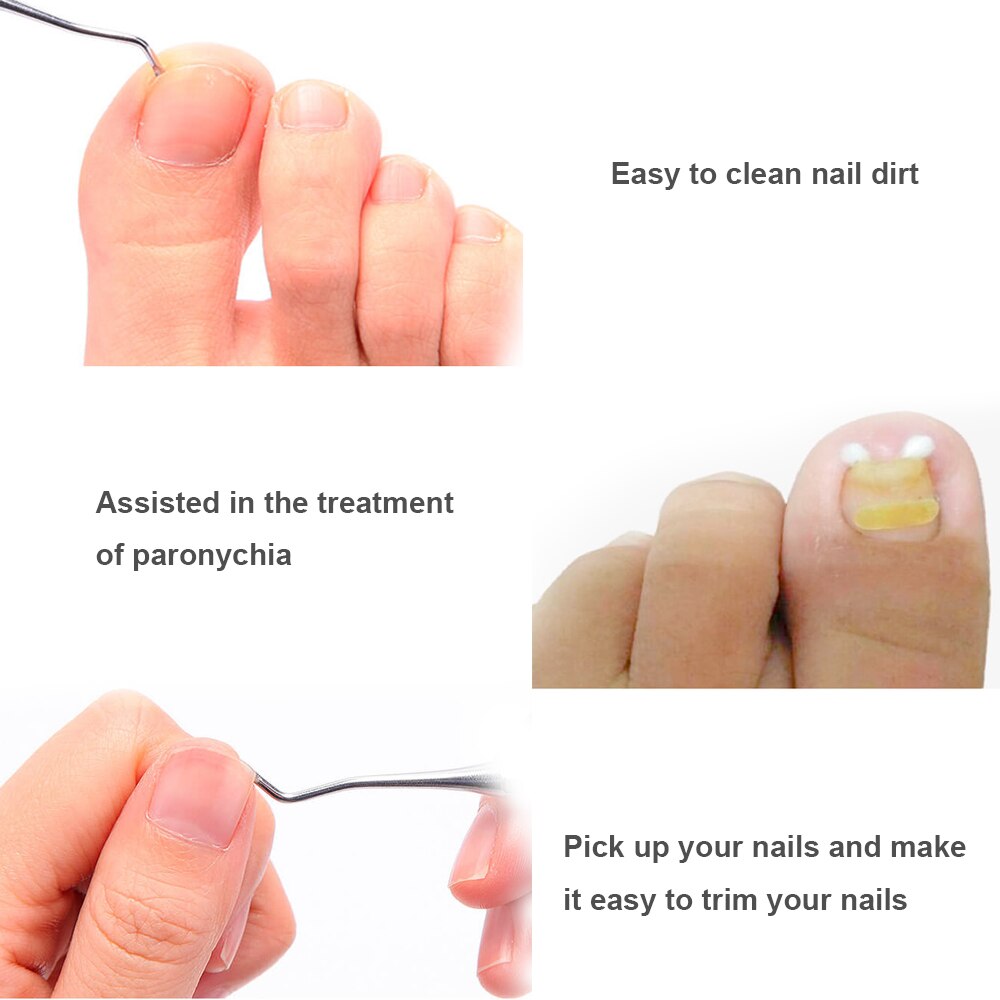 Colher levantador de unha encravada, cabeça dupla, ferramenta de manicure e pedicure, pés, limpeza de sujeira, em aço inoxidável