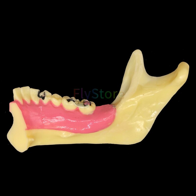Dental Mandibular Teaching Model Teeth Demonstration Anatomical Study