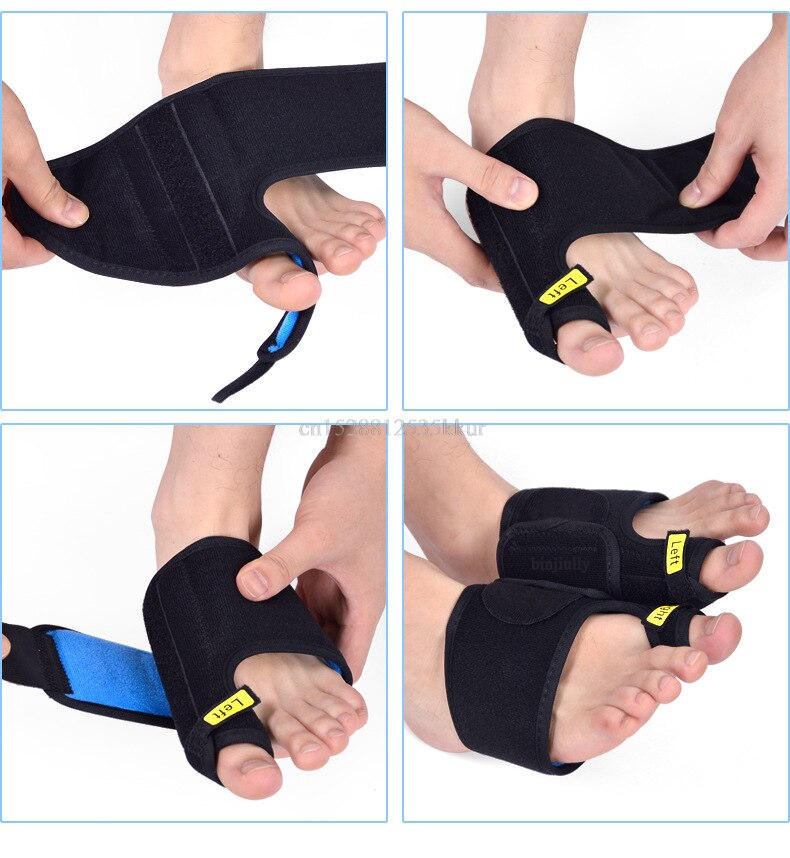 Hallux valgus pro tåkorreksjon tommeltape fysisk smertelindring stort beintåkorrektor magnetisk belte 1 stk.