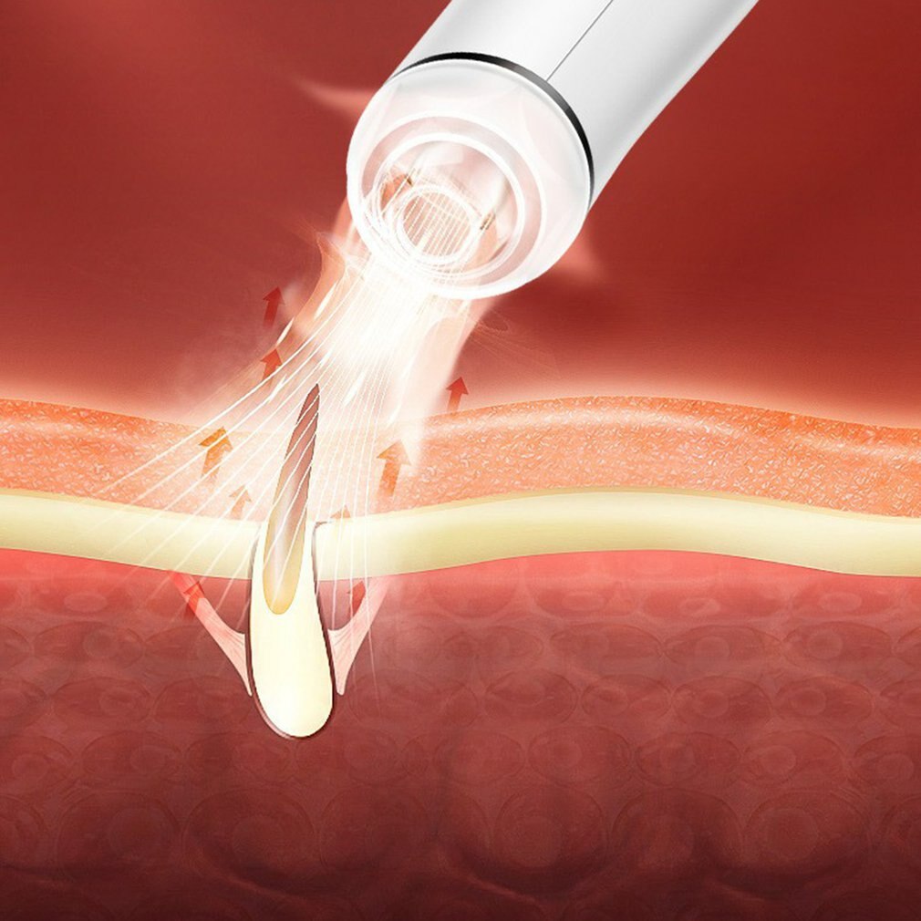 Schoonheid Instrument Mee-eter Zuigkracht Instrument Elektrische Poriën Schoonheid Instrument Porie Schoner Mee-eter Removal Tool
