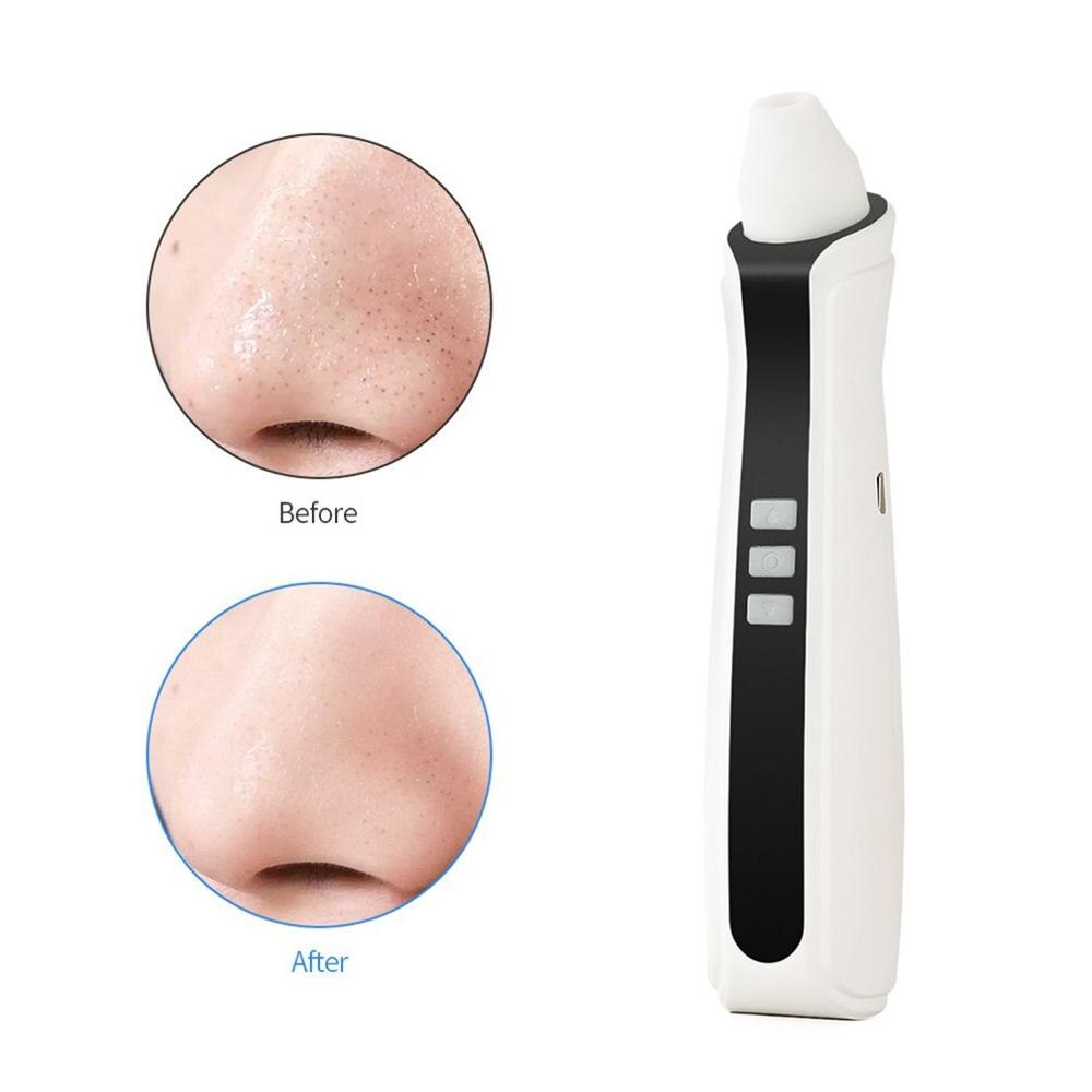 Nettoyeur de points noirs visuel Rechargeable USB Pores du visage aspirateur de tête noire 500X caméra de Microscope WIFI
