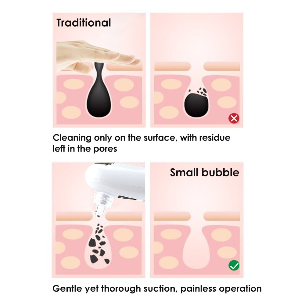 Electric Blackhead Remover Small Bubble Heated Facial Pores Clean USB Rechargeable Pore Vacuum Cleaner Pore Acne Pimple Remover