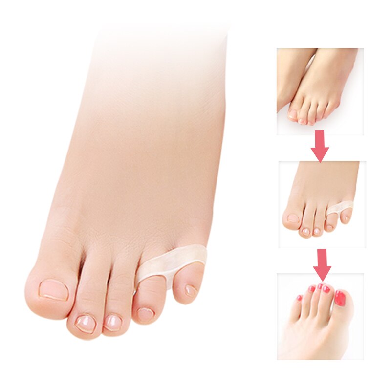 1-10 pair toe separador-interdigital-corrector-silicone-guarda pé-dedo-cuidado-ferramentas-alisador de união-pedicure-ortopédico