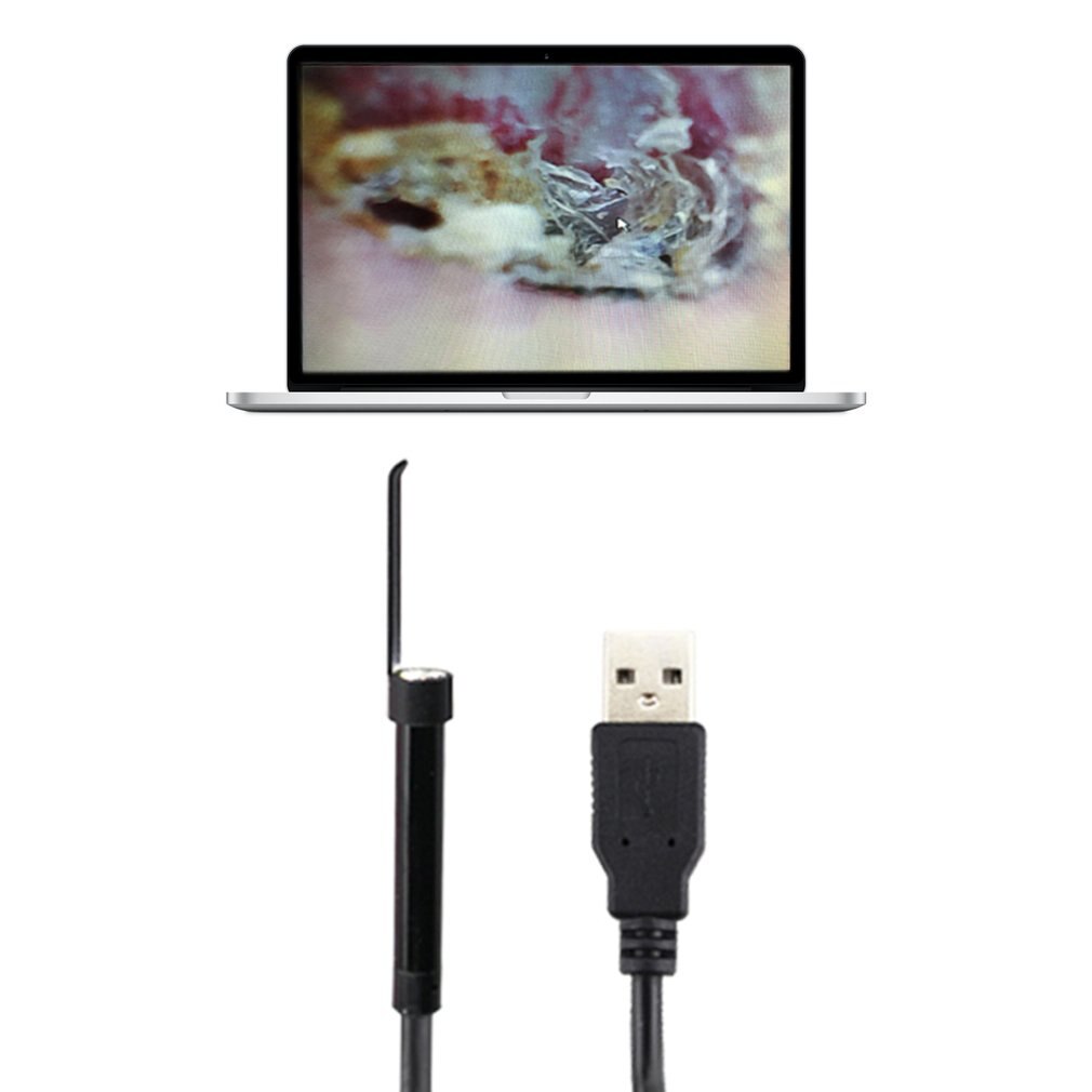 PVC Resin USB Ear Cleaning Tool Ear Cleaning Endoscope HD Visual Ear Spoon Multifunctional Earpick Ear Spoon Health Care: for windows