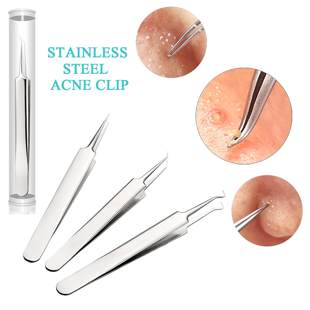 Blackhead Pimple Acne Remover Tool Spoon for Face Cleaning Skin Care Acne Tweezers Comedone Blemish Extractor Needle