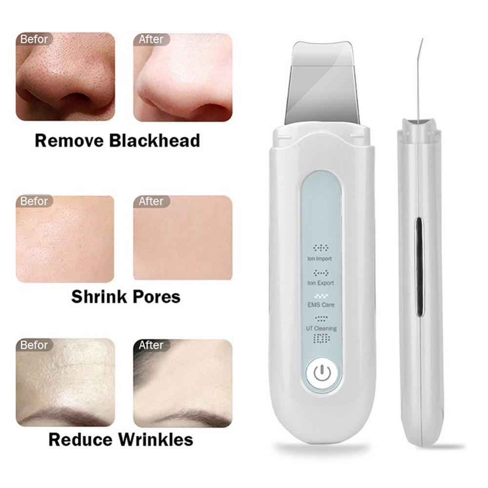 Ultrasound Skin Scrubber Exfoliërende Anti-Rimpel Huid Mee-eter Modellen Remover Spatel Huid Scrubber 4 Gereedschap Met D3J1