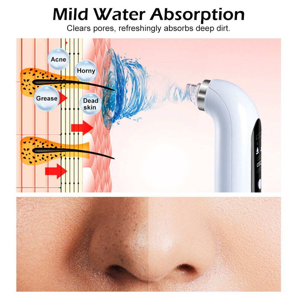 Rechargeable Skin Scrubber Bubble Blackhead Remover Pore Acne Pimple Removal Vacuum Suction Facial Beauty Products Skincare Tool