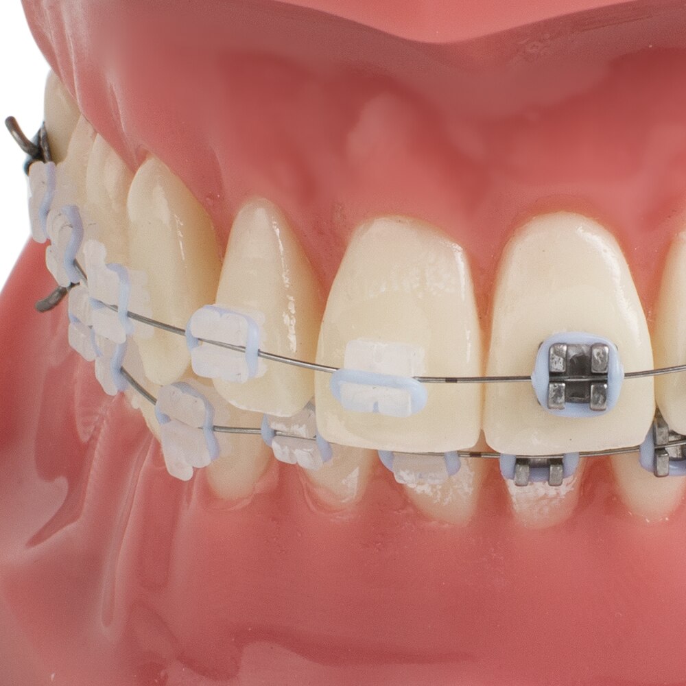 Dental Tanden Studie Orthodontische Rode Model met Metalen en Keramische Brackets Orale Demonstreren Modellen