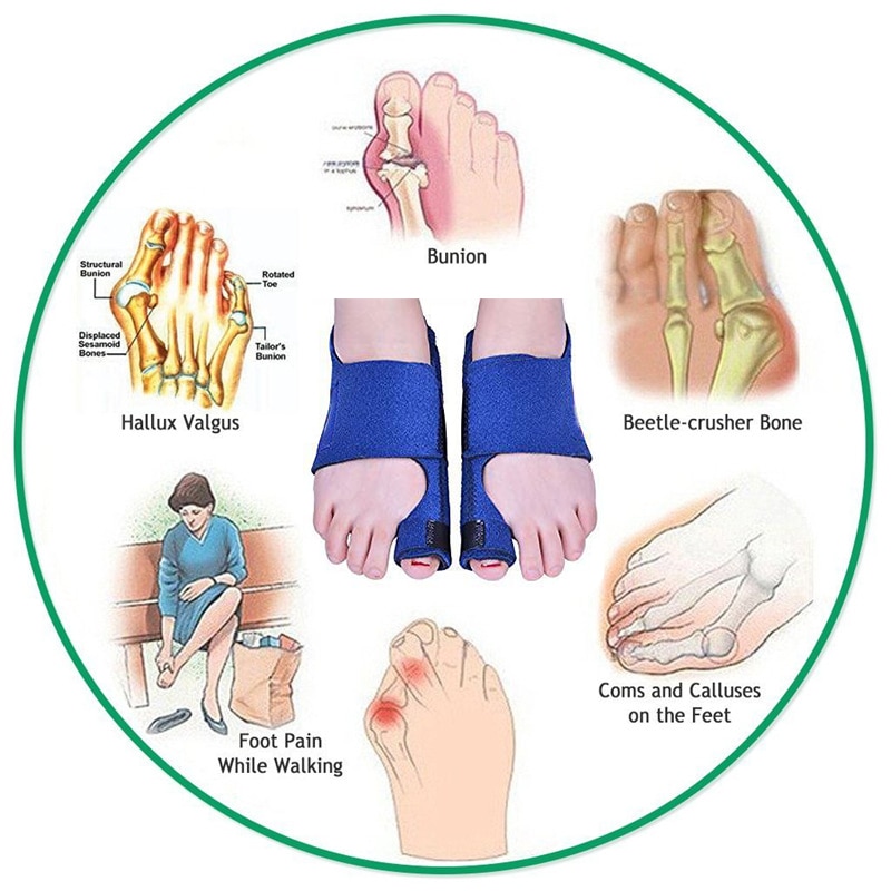 Bunion Corrector Spalk Toe Straightener Brace Voor Hallux Valgus Pain Relief Voetverzorging Hallux Valgus Corrector Orthopedische Gereedschap