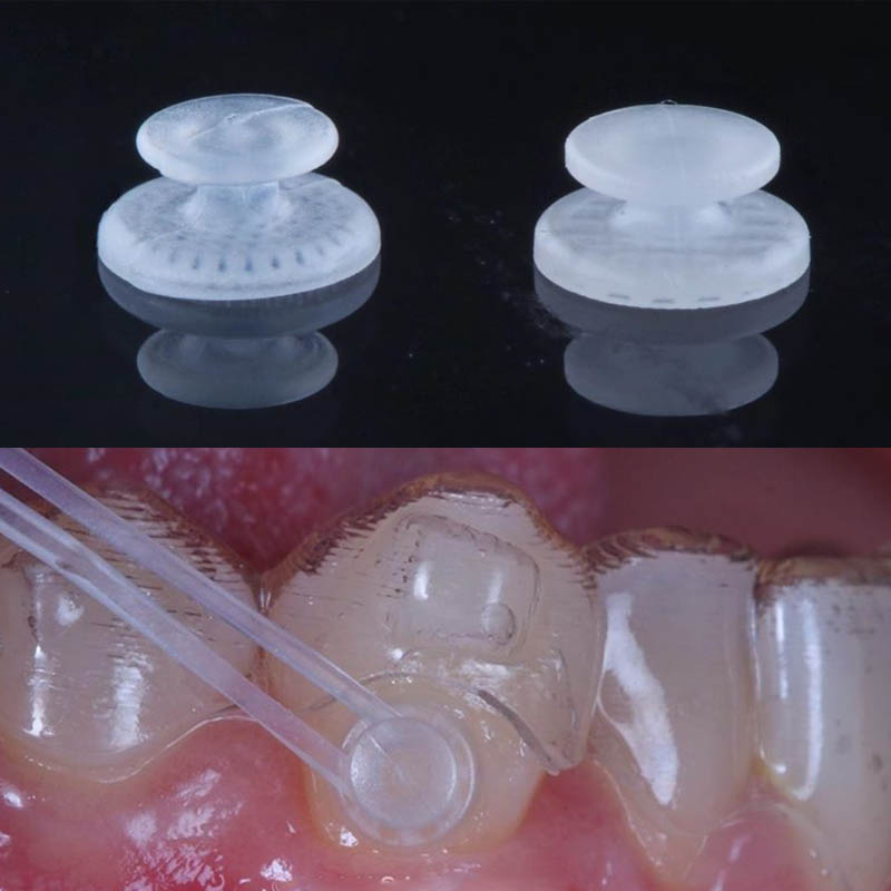 Dentst 50 pièces/boîte dentaire orthodontique bouton lingual collable Base en maille métallique pour supports de traitement d'orthodontie bretelles