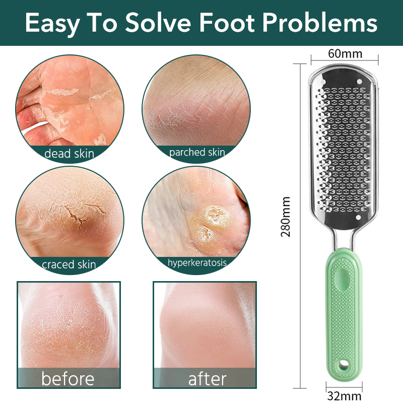 Ponceuse professionnelle pour les pieds, outil de pédicure, en acier inoxydable, enlève les callosités et les peaux mortes, râpe remplaçable, coupe exfoliante