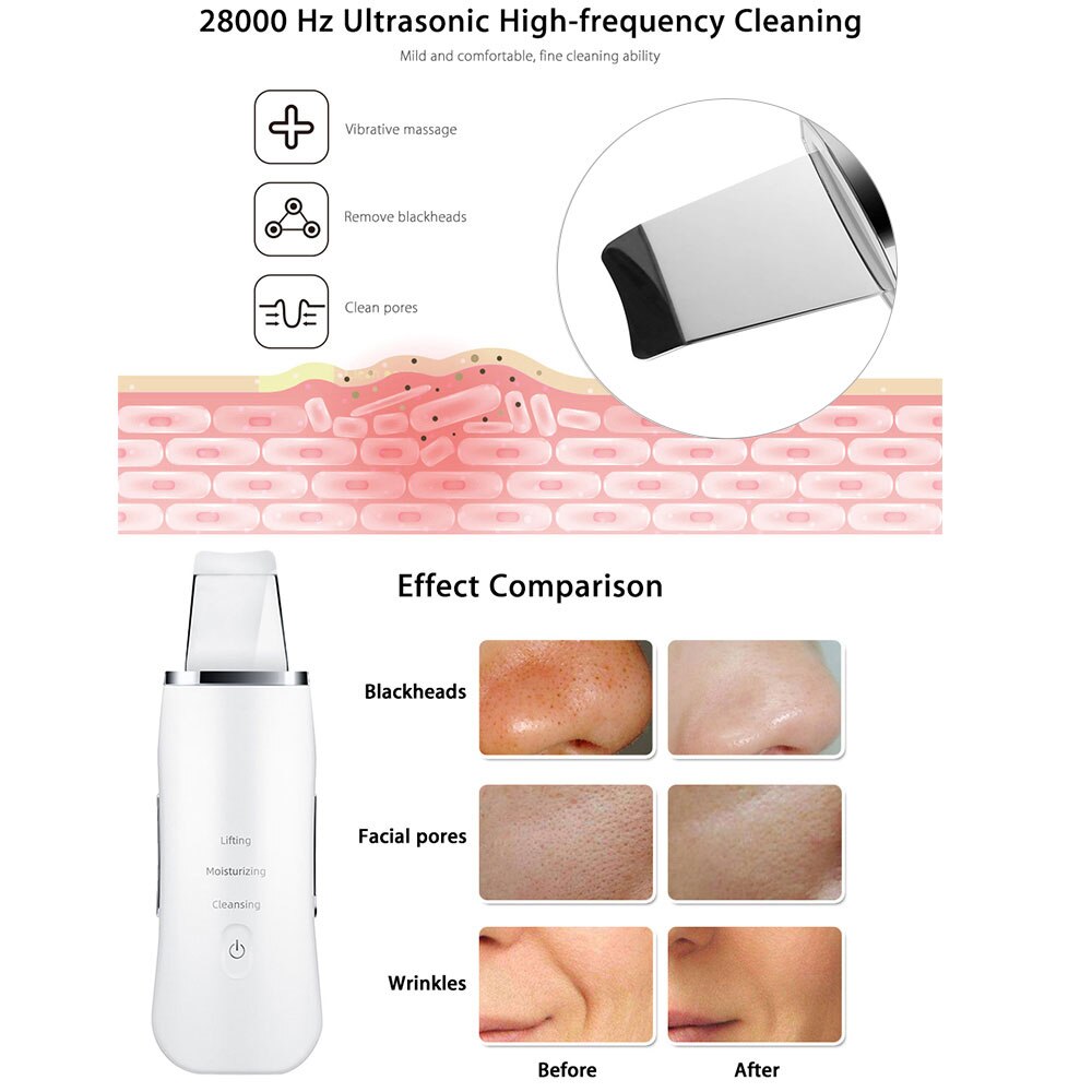 Ultrasonic Skin Scrubber Inductive Atomization Ion Deep Face Cleaning Peeling Face Vibration Remove Pore Blackhead Wrinkles