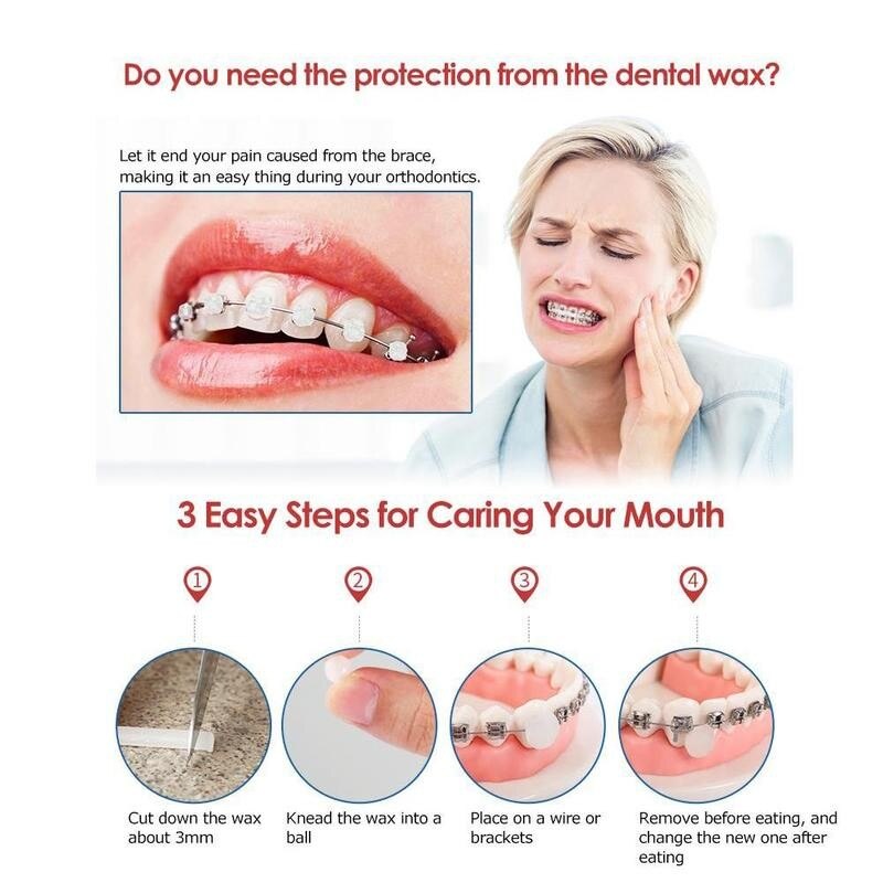 1 Box Dental Orthodontische Ortho Wax Voor Fruit Flavour Bretels Beugel Gum Tanden Bleken Mondhygiëne Anti-Maagzweer Schoonmaken tool