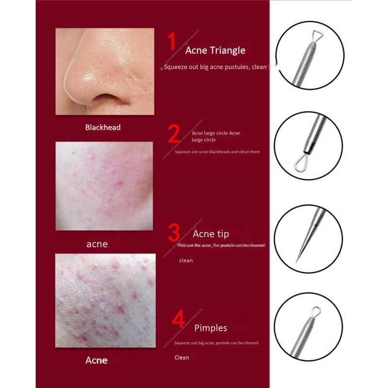 Acne Nose Blackhead Remover White Head Tool Pimple Removal Needle