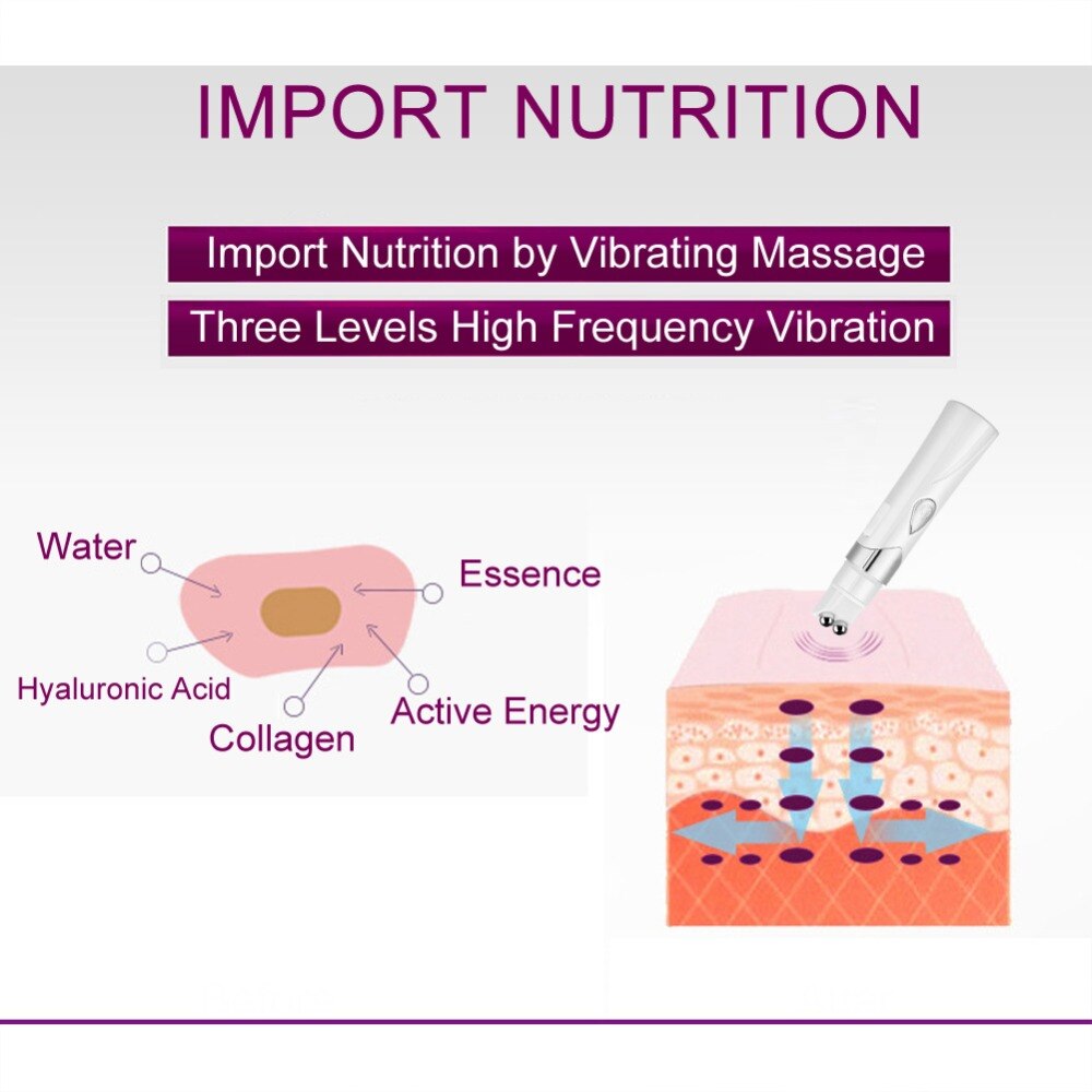 Oogverzorgingsinstrument, donkere kringen, wallen, rimpelverwijdering, elektrische vibratiemassager, bc