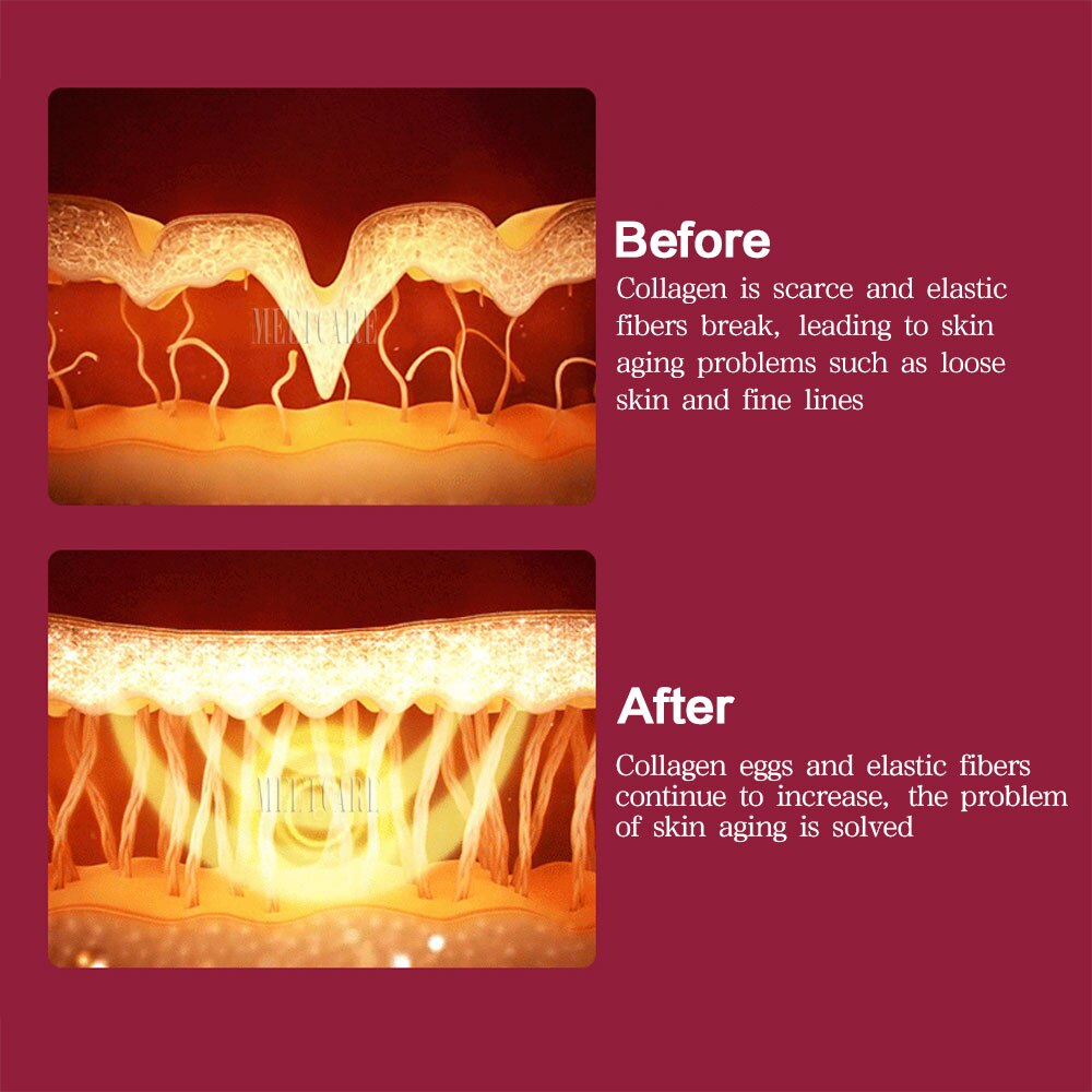 Portable Hifu High Intensity Focused Ultrasound Hifu Face Body Lift HIFU Wrinkle Removal Beauty Machine Skin Tightening Care