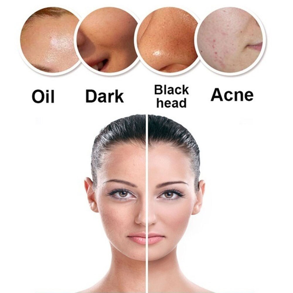 Ultrasonic Skin Scrubber Inductive Atomization Ion Deep Face Cleaning Peeling Face Vibration Remove Pore Blackhead Wrinkles