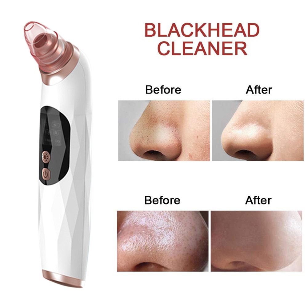 Small Bubble Blackhead Instrument Blackhead Removal Device Electric Face Cleaner Water Circulation Skin Beauty Instrument USB