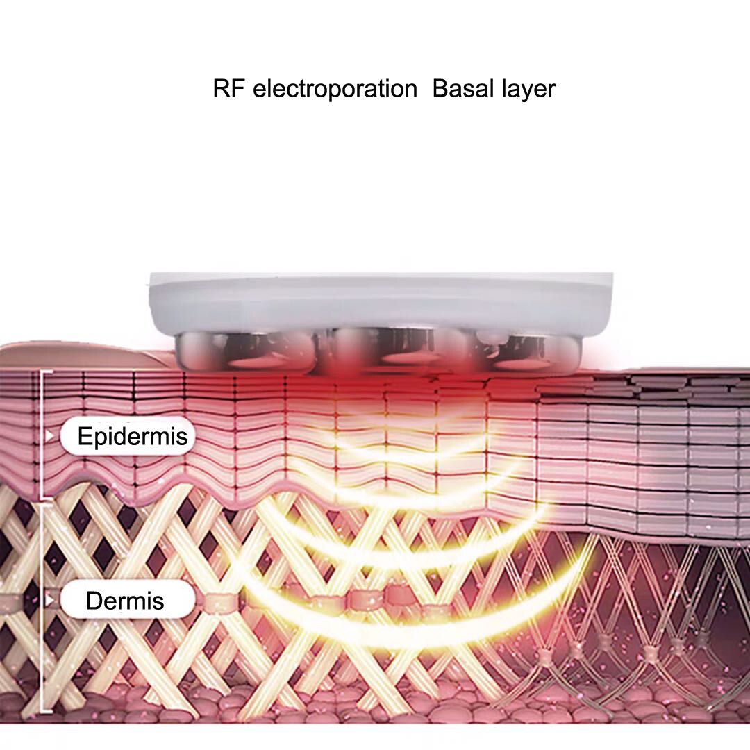Electroporation LED Photon facial RF Radio Frequency Facial EMS Mesotherapy Face skin rejuvenation remover Wrinkles