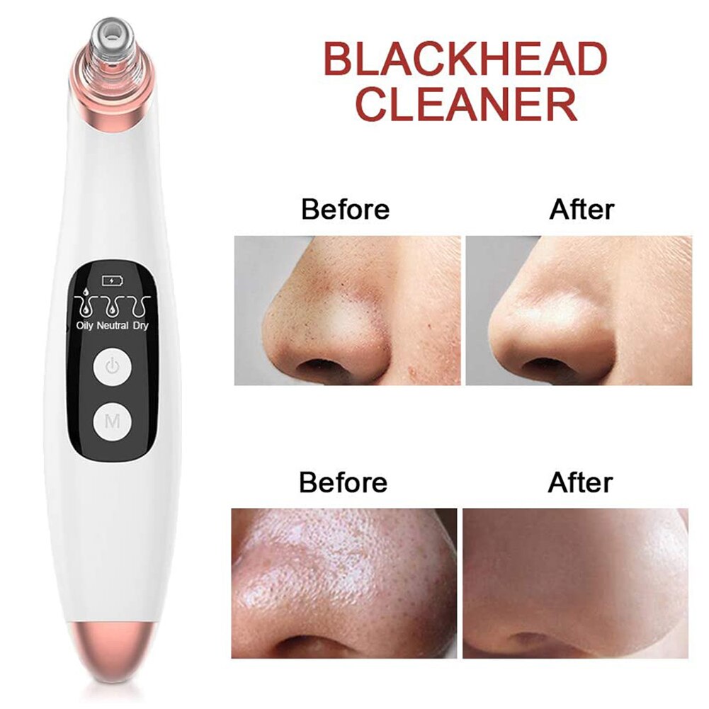 Blackhead Remover Point Noir Electric Acne Vacuum Extractor Suction Tool Black Spots Pore Cleaner Skin Care Facial Clean Machine