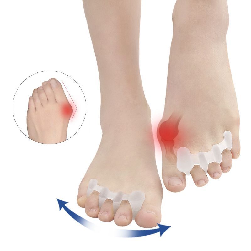 Pexmen 2 Teile/para Gel Zehe Separator Ballen Knochen Ektropium Erzähler Zehen Außen Gerät Fuß Pflege Werkzeuge Hallux Valgus Korrektor: Elfenbein