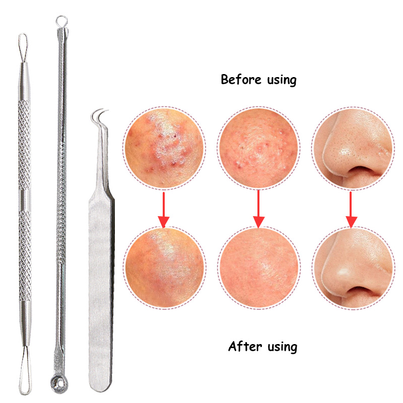 Stainless Steel Pimple Acne Extractor Blackhead Remover Needles Pimple Blemish Acne Treatments Face Skin Care Tools Needles Set