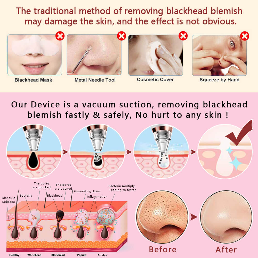 Blackhead Acne Remover Vacuum Machine Black Head Face Skin Care Cleaner Pore Nose Suction Facial Removal Extractor
