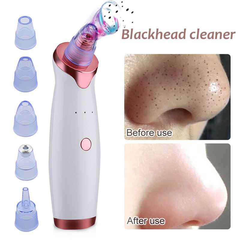 Limpiador de poros Facial eléctrico, exfoliante Facial, eliminador de espinillas, máquina de succión al vacío de acné, Nano pulverizador