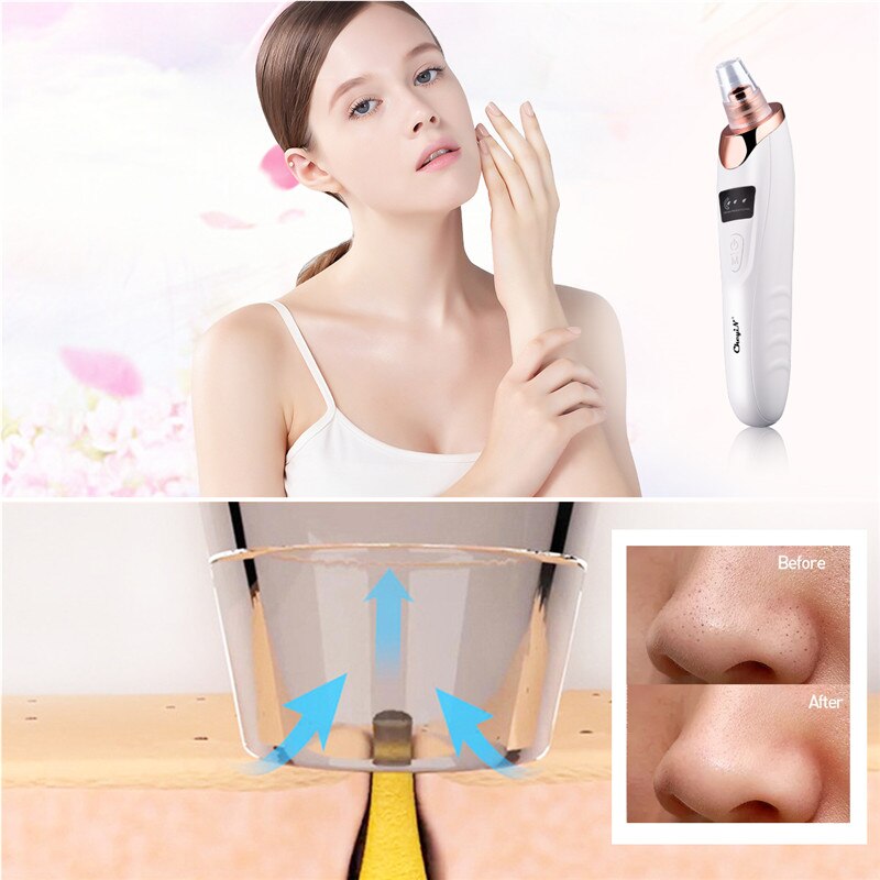 Blackhead Acne Remover Electric Facial Deep Cleansing Nose Vacuum Suction Pore Cleaner Black Dot Remover Machine Skin Care Tool