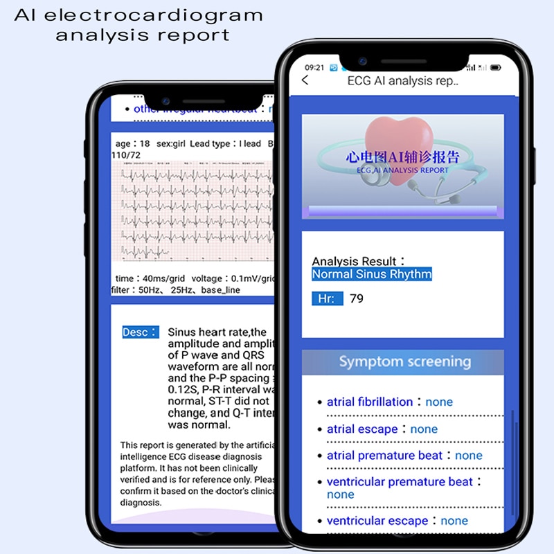 M8 AI electrocardiogram temperature Smart watch Heart Rate Monitor ECG PPG Smart Bracelet Blood Pressure Clock Wristband