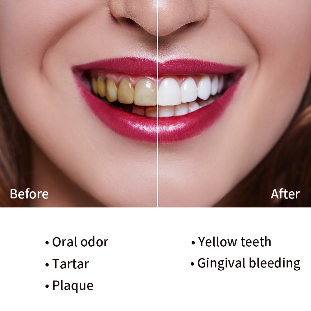 Electric Toothbrush USB Charge Rechargeable Tooth Brushes Washable Electronic Top Smart Chip Toothbrush with 4 Brush Hea