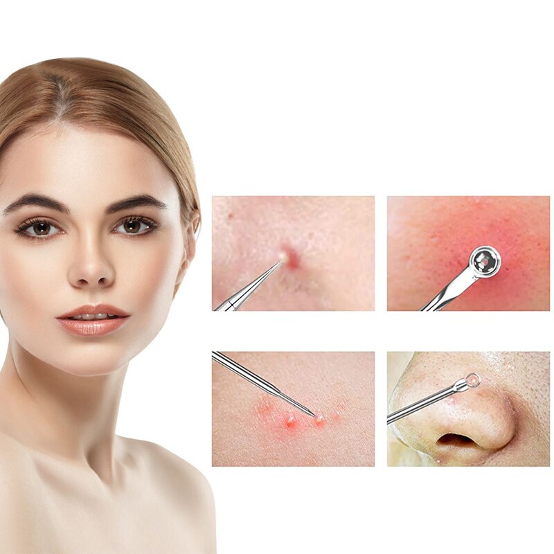 4pcs/set Rose Gold Blackhead Comedone Acne Pimple Belmish Extractor Vacuum Blackhead Remover Tool Spoon for Face Skin Care Tools