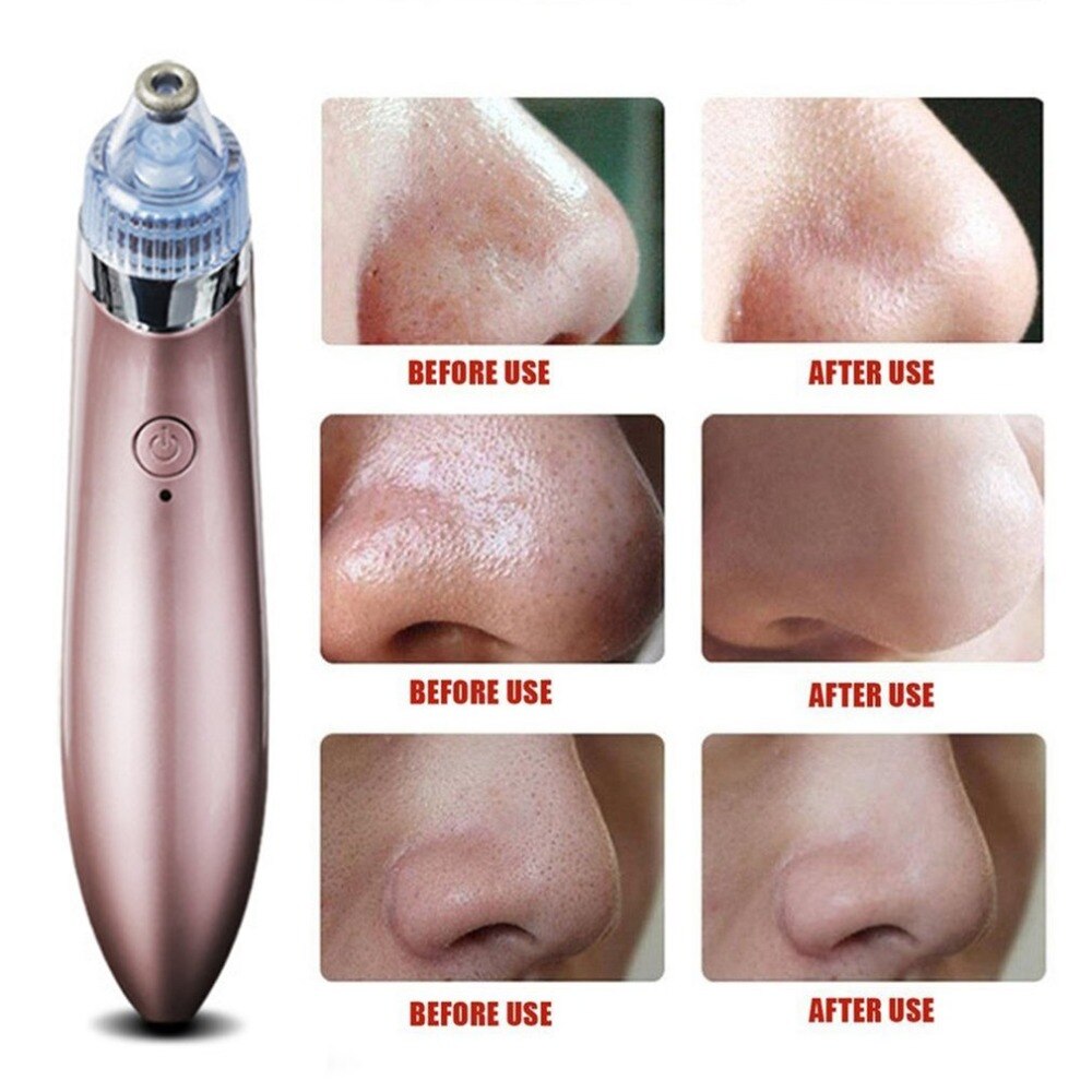 Huidverzorging poriën vacuüm mee-eter verwijderaar acne puistjes verwijderen gezichtsreiniging diamant dermabrasie machine vacuüm zuiggereedschap
