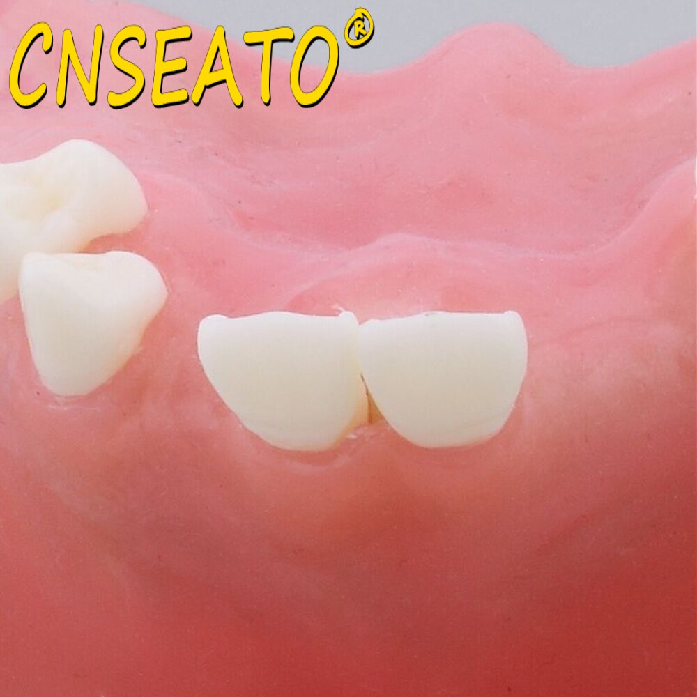 Dental Teeth Model Sinus Lift Practice Maxillary Bone Dentistry Tooth Models Dentist Teaching Demonstration Implant Simulator