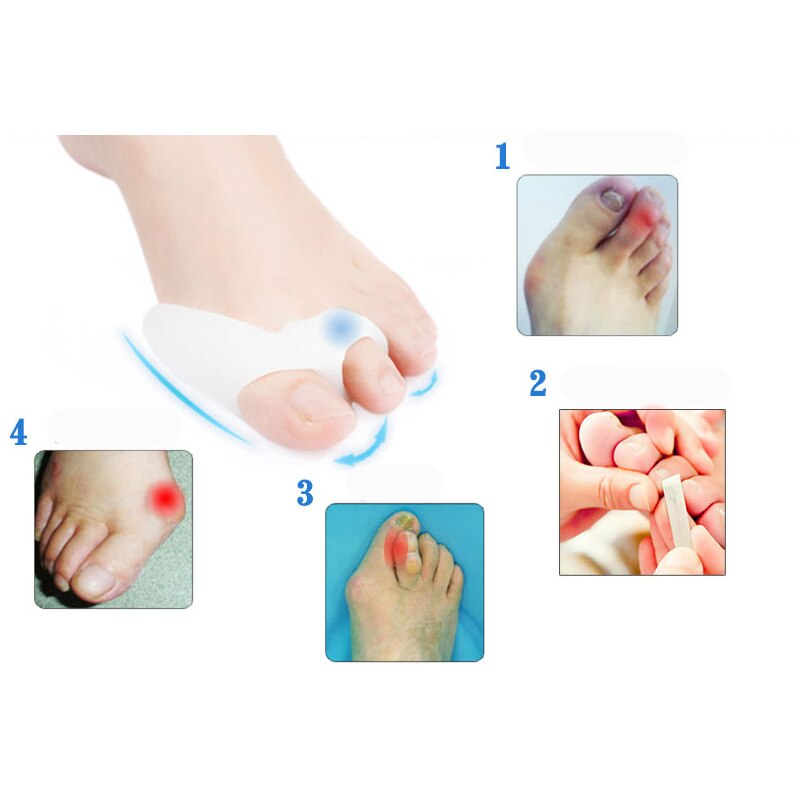 20pcs=10pairs Gel Toe Ring Toe Separator Protector Bunion Adjuster Guard Silicone Thumb Hallux Valgus Correction Foot Care Tool