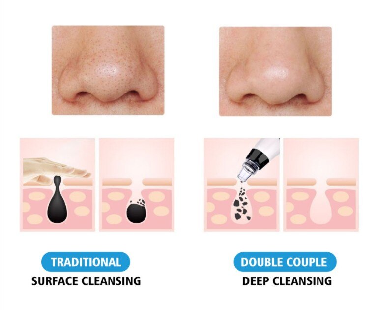 Blackhead Remover Facial Cleanser Deep Pore Removal Acne Pimples Aspiration Facial SPA Diamond Skin Care Beauty Care Tool