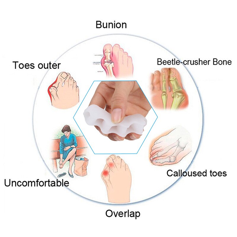 Ifory 1 paar Zehe Separator Finger Hallux Valgus-Zeh Fuß Knochen Authentische Überlappenden Zehe Korrektur Korrektur Separator