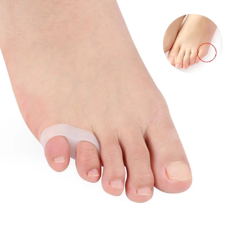 1-10 pair toe separador-interdigital-corrector-silicone-guarda pé-dedo-cuidado-ferramentas-alisador de união-pedicure-ortopédico