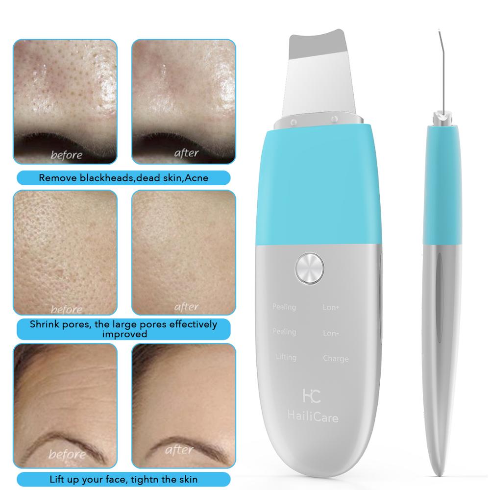 Ultrasonic Face Cleaning Skin Scrubber Facial Cleaner Skin Peeling Blackhead Removal Pore Cleaner Face Scrubber