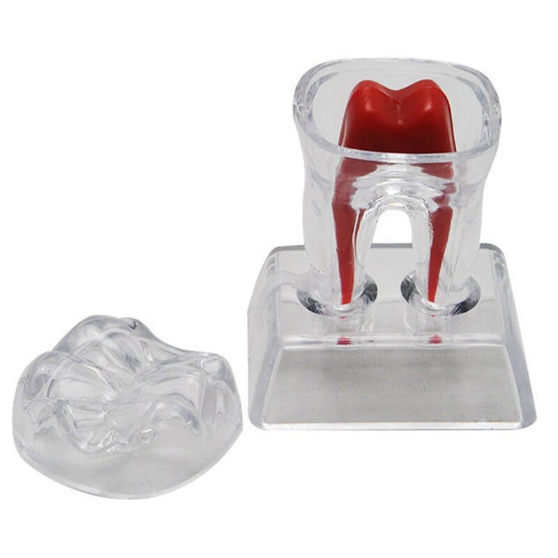 Large Tooth Molar Model Separable Teaching Demonstration Model Transparent Dentistry Material Lab Teeth Model