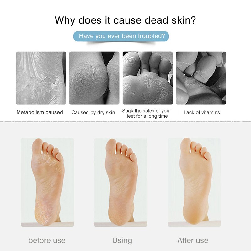 Nueva lima Manual portátil para raspar los pies, eliminador de callos de piel muerta, pedicura, pies, limas, herramientas profesionales para el cuidado de los pies